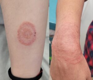 פטריה בעור בצורת עיגול - פטריה ביד